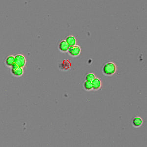Acridine Orange / Propidium Iodide (AO/PI) Viability Assay