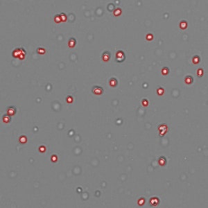 Acridine Orange / Propidium Iodide (AO/PI) Viability Assay