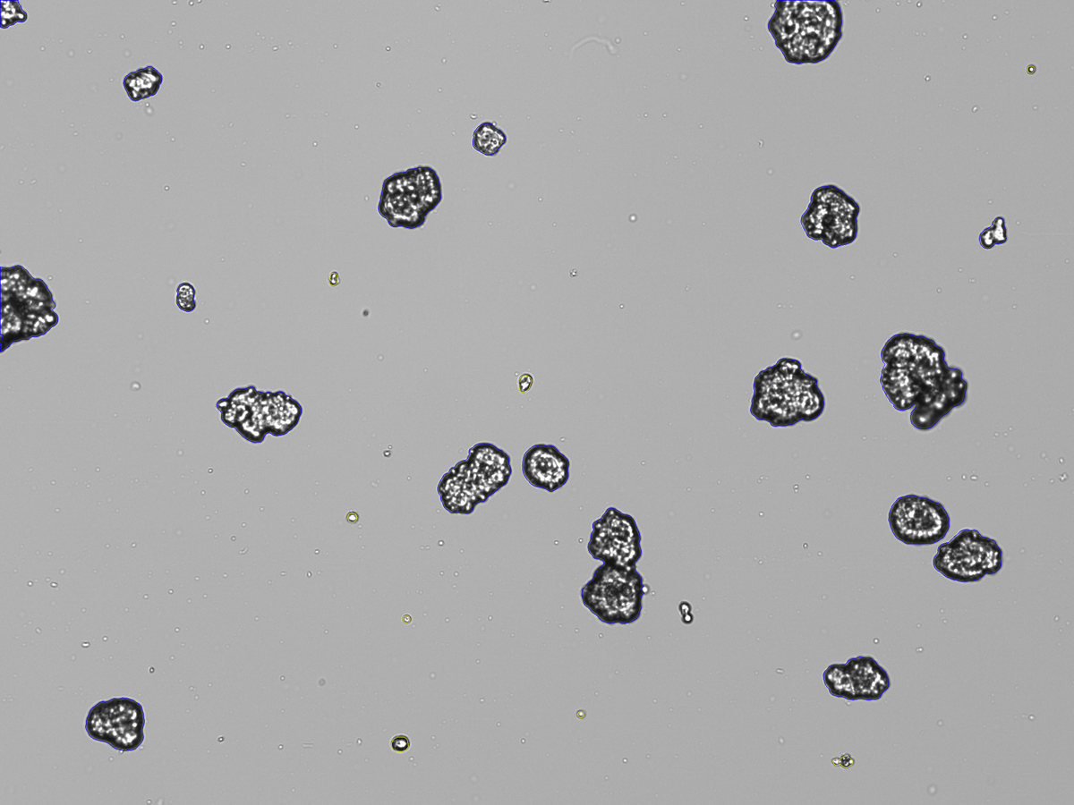 Organoids Count