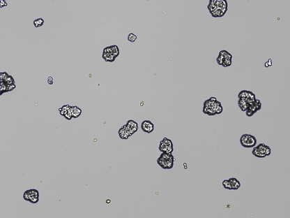 Organoids Count